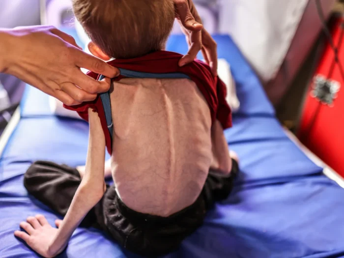 PAL Commission & Euro-Med Monitor issue urgent call to action on forced starvation